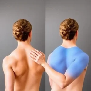 Die besten Schulter Impingement Übungen für schnelle Linderung!